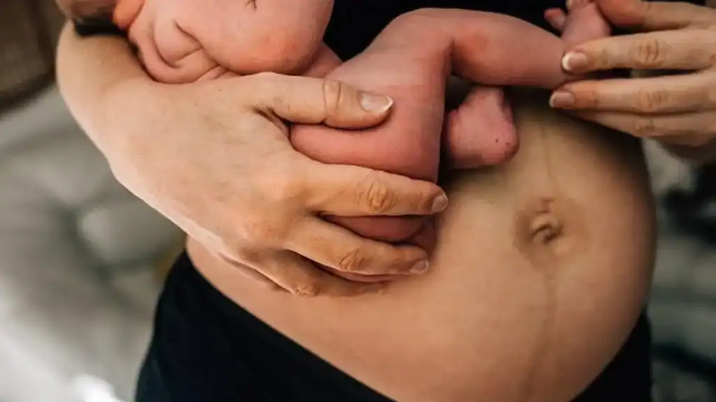 Why Is My Stomach Still Big After Pregnancy Dumfries?